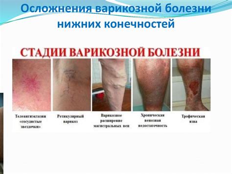 Осложнения после перекрещивания конечностей