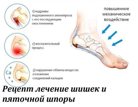 Основные методы лечения одностороннего отека ноги