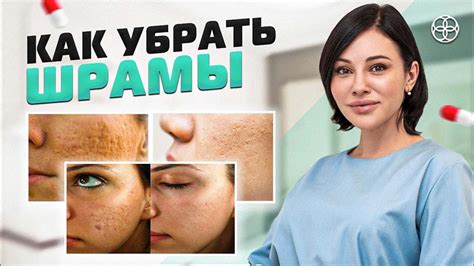 Основные методы лечения шрамов и рубцов