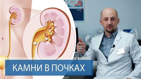 Основные признаки камня в почке