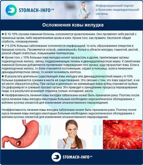 Основные симптомы возникновения язвы