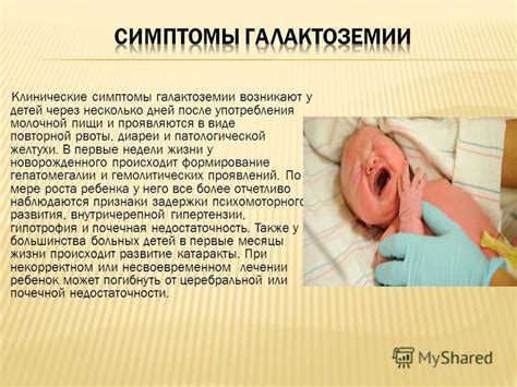Основные симптомы галактоземии у детей