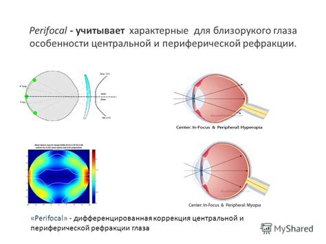 Особенности ведения тренировки для близорукого
