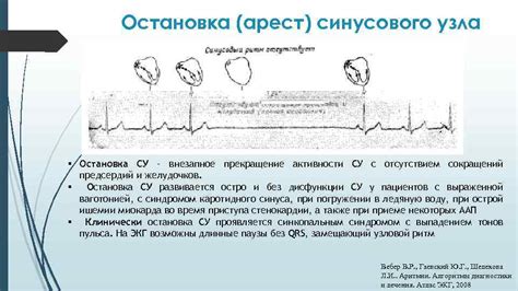 Остановка работы узла