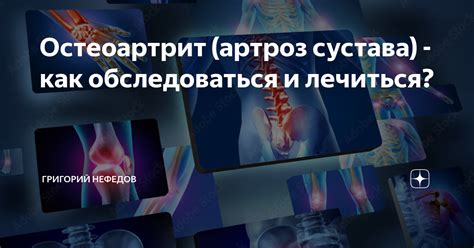 Остеоартрит и артроз