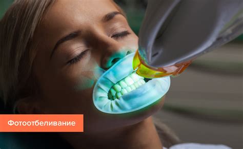 Отбеливание зубов