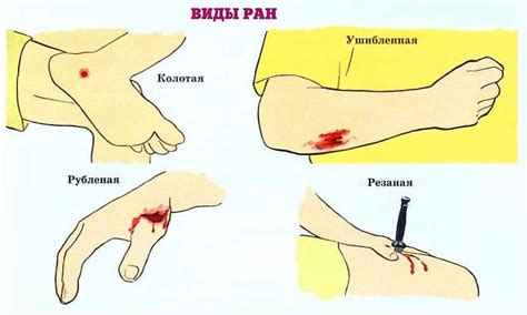 Открытые раны: как избегать повторения больных отношений