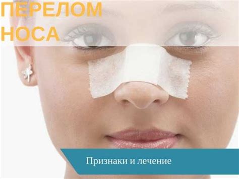 Отличительные признаки ушиба носа от перелома
