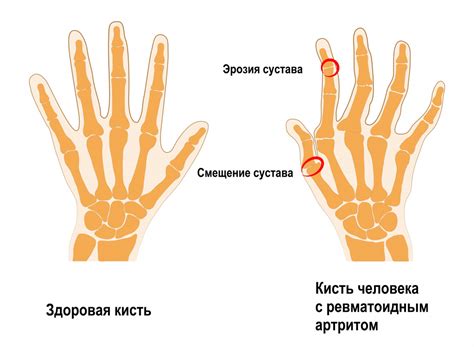 Отличия сатурации на пальцах у разных людей