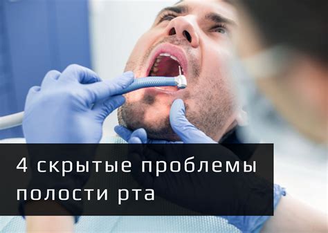Отсутствие заболеваний полости рта