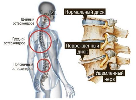 Пальцевое определение шейки позвоночника