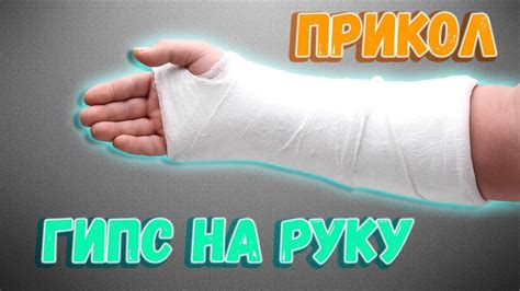 Пальцы в гипсе: как развить подвижность