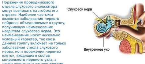 Патологии слухового нерва