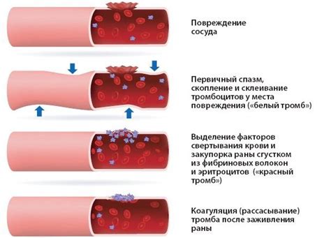 Патологические причины свертывания крови при сдаче