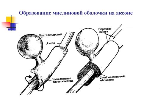 Перспективы восстановления миелиновой оболочки нерва