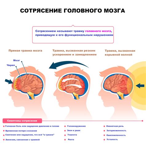 Перспективы развития рентгеновской диагностики сотрясения головного мозга