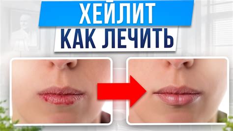 Питательное питание и правильный уход за губами