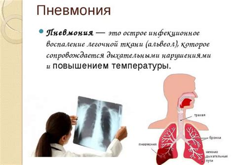 Пневмония: причины и температура