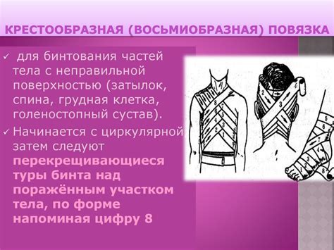 Повежение и уход за повязкой: основные рекомендации
