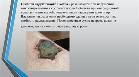 Повреждение окружающих тканей