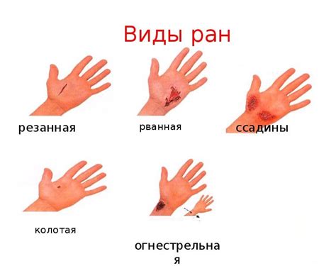 Повреждения кожи и горла