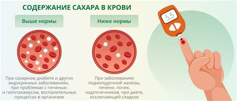 Повышение уровня сахара в крови: полезные советы и рекомендации