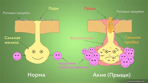 Повышенная выработка гормонов и ее последствия