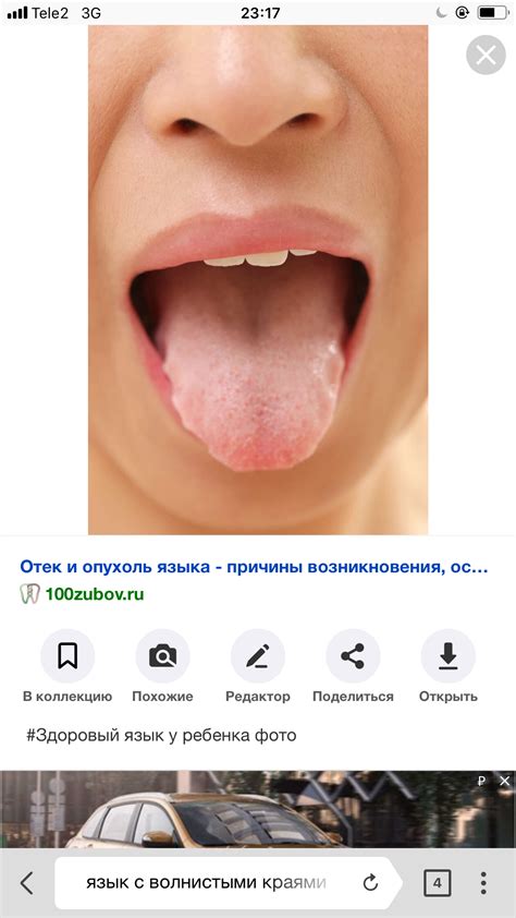 Повышенная жажда и сухой язык