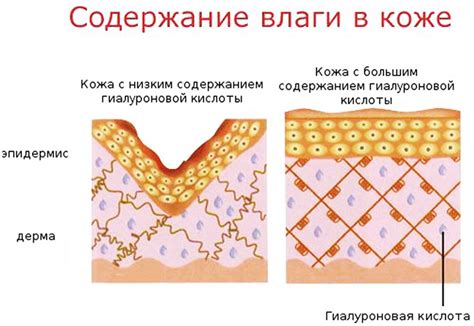 Повышенное содержание влаги в коже
