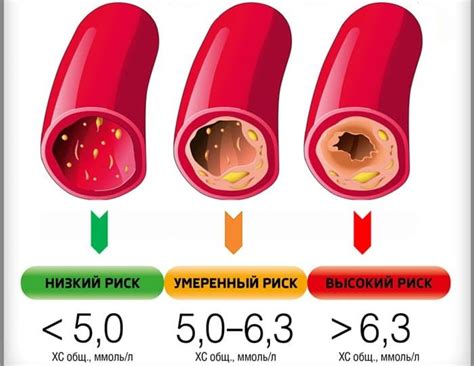 Повышенный холестерин в крови