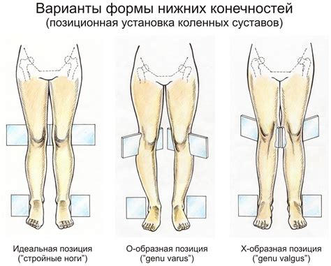 Подготовка и установка ног и стоп