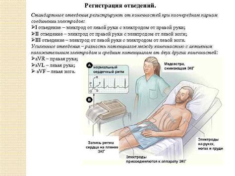 Подготовка к ЭКГ