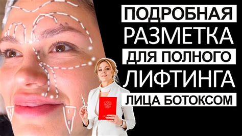 Пожелания специалистов: советы по использованию ботокса для профилактики дома
