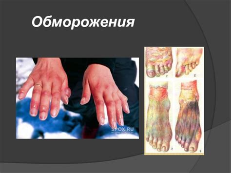 Покалывание и ожоги