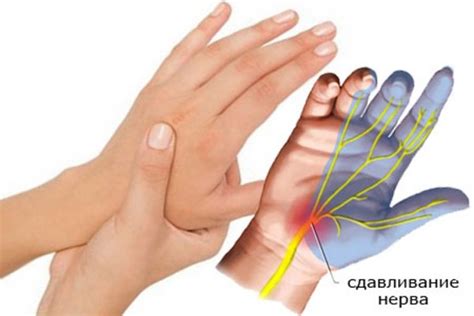 Покалывание как симптом серьезного заболевания