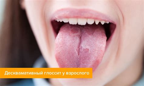 Полное или частичное обгорание пня