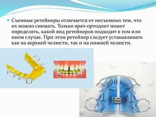 Польза и результаты от использования ретейнеров на верхней челюсти