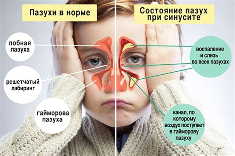 Последствия, если ребенка не пробудить