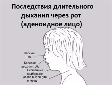 Последствия длительного задержания дыхания