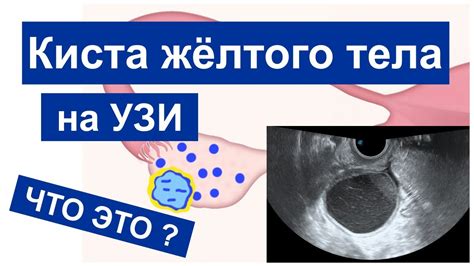 Последствия рождения без левого яичника