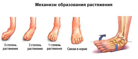 Последствия травмы: какая травма может вызвать потерю пальца