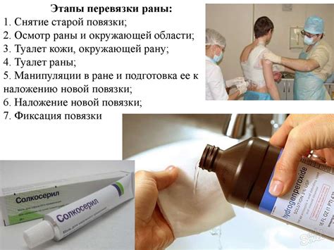 Послеоперационный уход и рекомендации