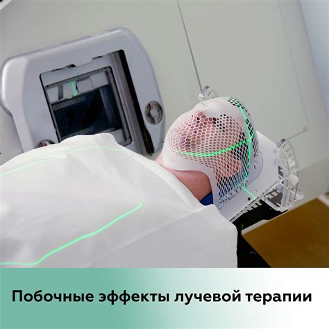 После лучевой терапии возникают серьезные побочные эффекты