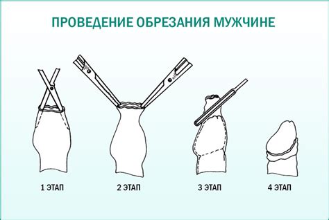 Потенциальные психологические аспекты обрезания у мужчин