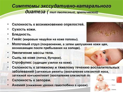 Потница: проявления и диагностика