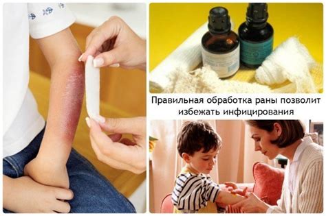 Почему важно обработать рану правильно