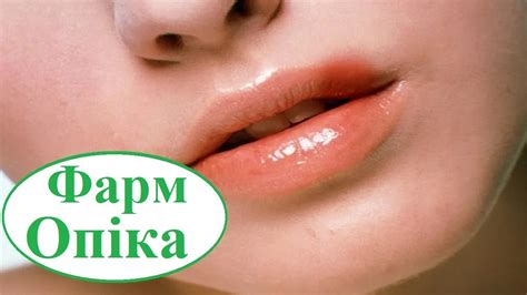 Почему вылезает пупирка на губе и где искать причину