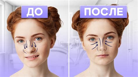 Почему массаж помогает уменьшить нос без хирургии