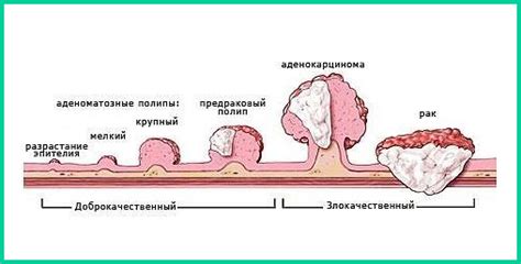 Появление полипов