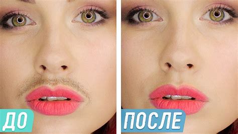 Появление тонких волосков над верхней губой